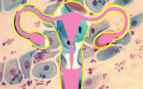 paper smear test for white discharge|Abnormal Pap Smears: What They Mean & What Happens Next.